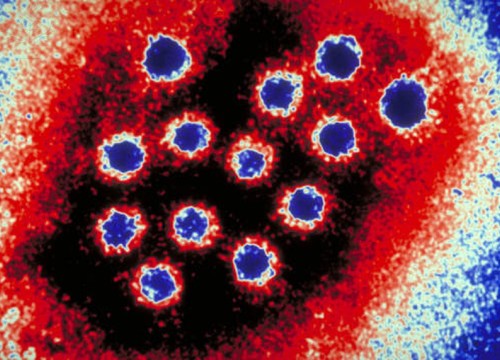 Hepatitis A Virus photo from ImageQuest